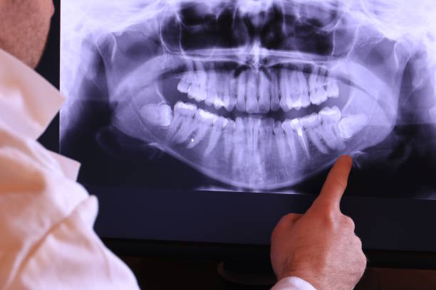 Best Emergency Gum Treatment in Shawsville, VA