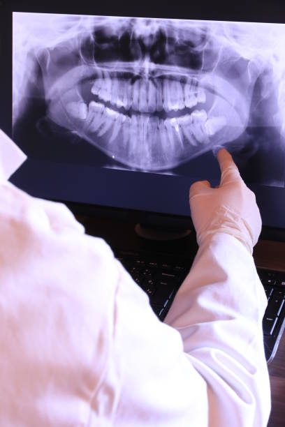 Best Emergency Root Canal Treatment in Shawsville, VA