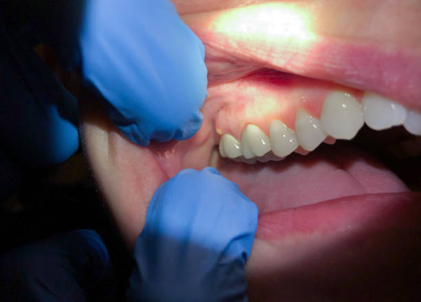 Best 24-Hour Emergency Dentist in Shawsville, VA